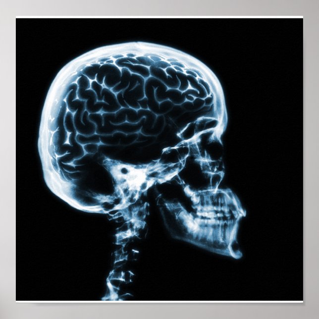 X-RAY SKULL BRAIN - BLUE POSTER (Framsidan)