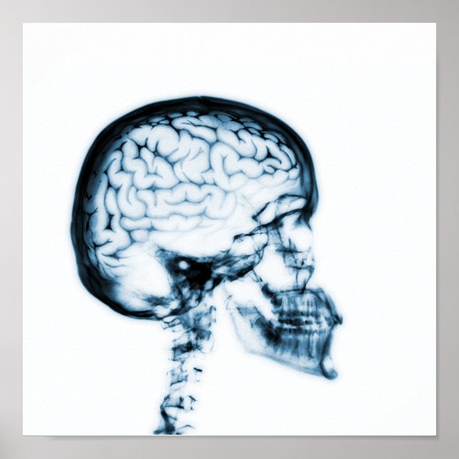 X-RAY SKULL BRAIN - BLUE POSTER (Framsidan)
