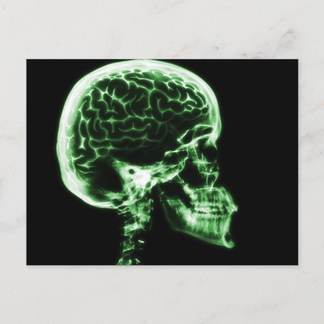 X-RAY SKULL BRAIN - GRÖNT VYKORT (Framsida)