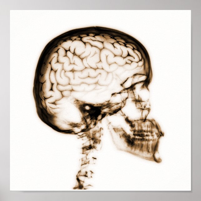 X-RAY SKULL BRAIN - ORANGE POSTER (Framsidan)