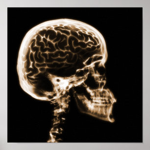 X-RAY SKULL BRAIN - ORANGE POSTER