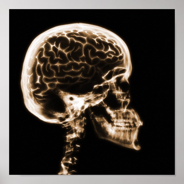 X-RAY SKULL BRAIN - ORANGE POSTER (Framsidan)