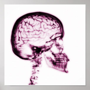 X-RAY SKULL BRAIN - ROSA POSTER