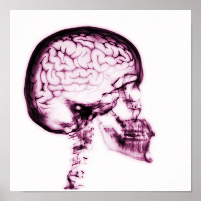 X-RAY SKULL BRAIN - ROSA POSTER (Framsidan)