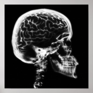 X-RAY SKULL BRAIN - SVART OCH VITT POSTER