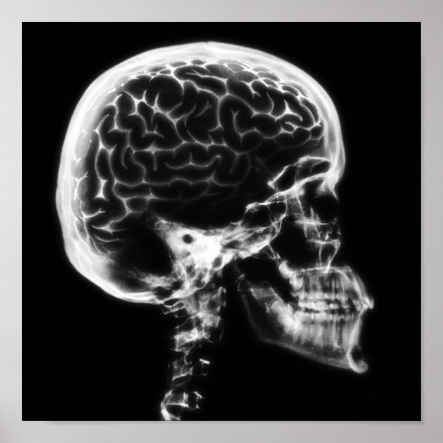 X-RAY SKULL BRAIN - SVART OCH VITT POSTER (Framsidan)