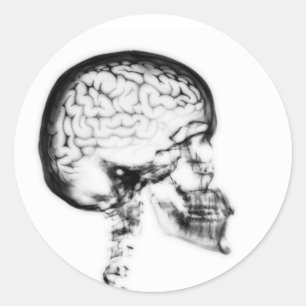 X-RAY SKULL BRAIN - SVART OCH VITT RUNT KLISTERMÄRKE
