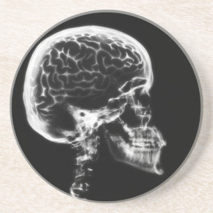 X-RAY SKULL BRAIN - SVART OCH VITT UNDERLÄGG SANDSTEN