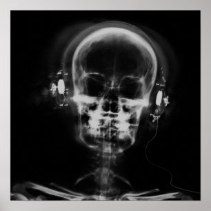 X-Ray Skull med hörlurar - B&W Poster