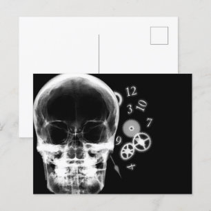 X-Ray Skull- och klockdelar - B&W Vykort