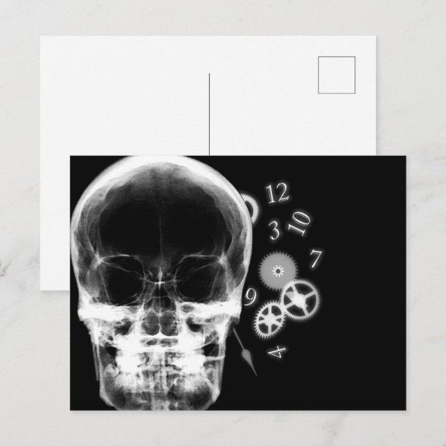 X-Ray Skull- och klockdelar - B&W Vykort (Fram/baksida)