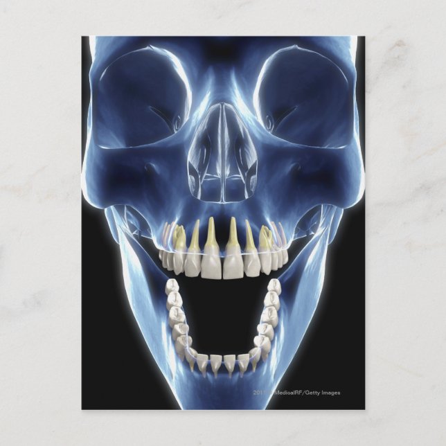 X-ray stil, titta på tänderna. vykort (Framsida)