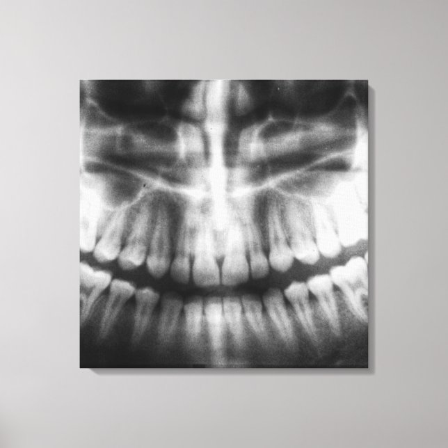 X-Ray Teeth Mouth Smile Black and White Canvastryck (Framsida)