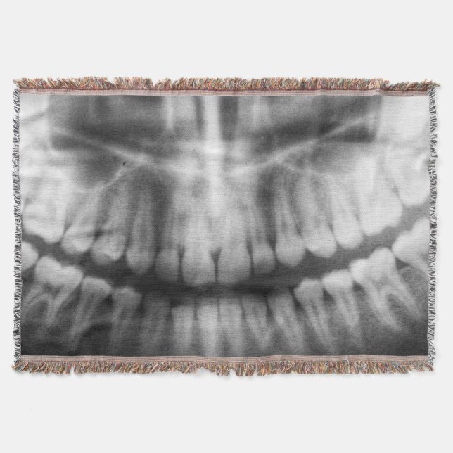 X-Ray Teeth Mouth Smile Black and White Filt (Framsidan)