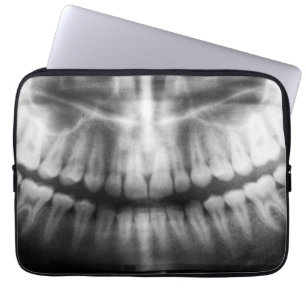 X-Ray Teeth Mouth Smile Black and White Laptop Fodral