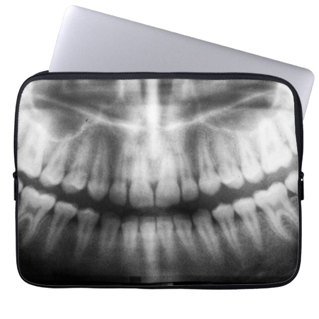 X-Ray Teeth Mouth Smile Black and White Laptop Fodral (Framsidan)