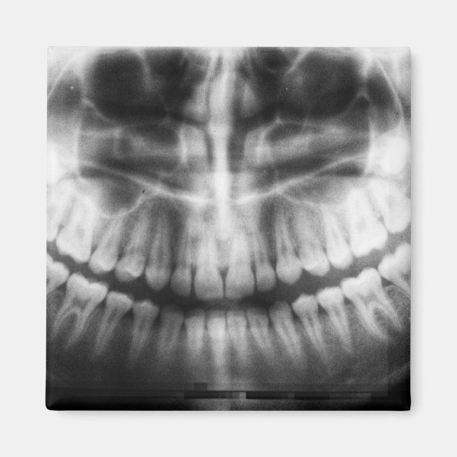 X-Ray Teeth Mouth Smile Black and White Magnet (Framsidan)