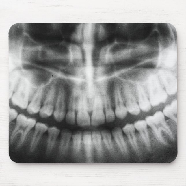 X-Ray Teeth Mouth Smile Black and White Musmatta (Framsidan)