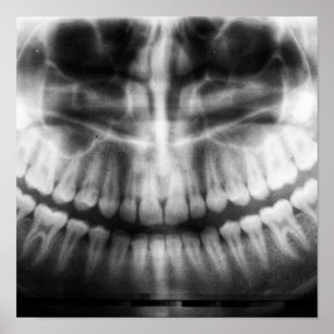X-Ray Teeth Mouth Smile Black and White Poster