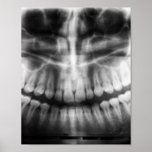X-Ray Teeth Mouth Smile Black and White Poster
