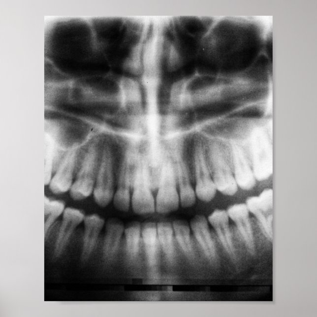 X-Ray Teeth Mouth Smile Black and White Poster (Framsidan)