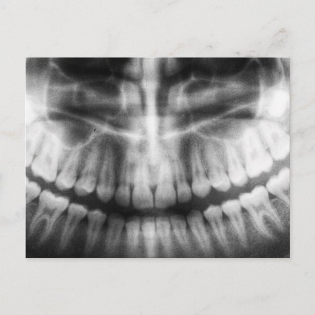 X-Ray Teeth Mouth Smile Black and White Vykort (Framsida)