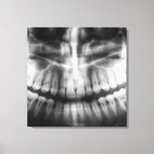 X-Ray Teeth Mouth Smiles Black and White Canvastryck