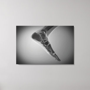 X-Ray View of Human Foot 4 Canvastryck