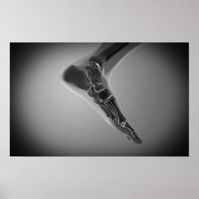 X-Ray View Of Human Foot 4 Poster (Framsidan)