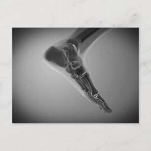 X-Ray View of Human Foot 4 Vykort