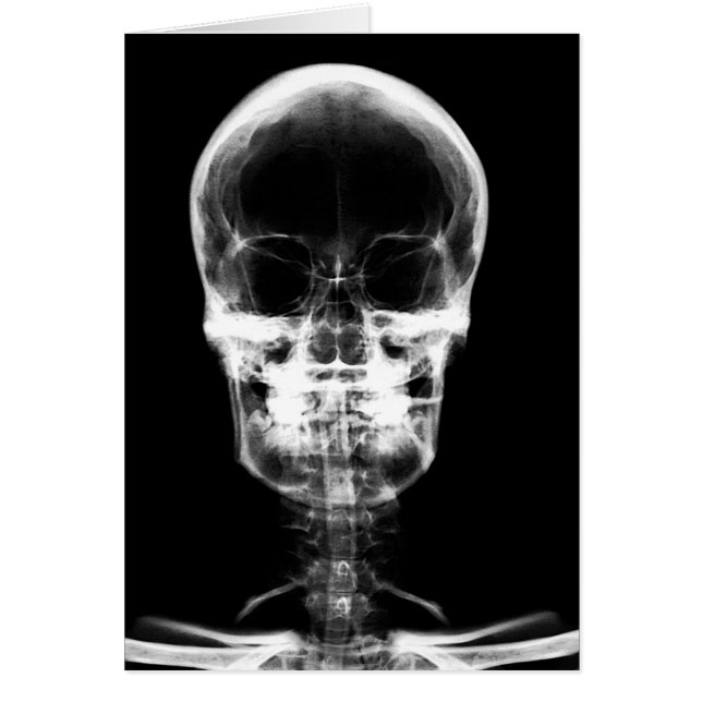X-RAY VISION SKELETON SKULL - B&W HÄLSNINGSKORT (Framsidan)