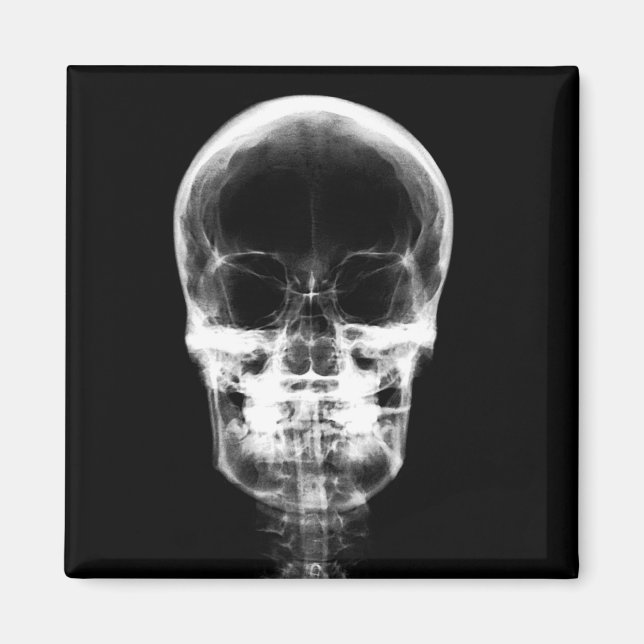 X-RAY VISION SKELETON SKULL - B&W MAGNET (Framsidan)