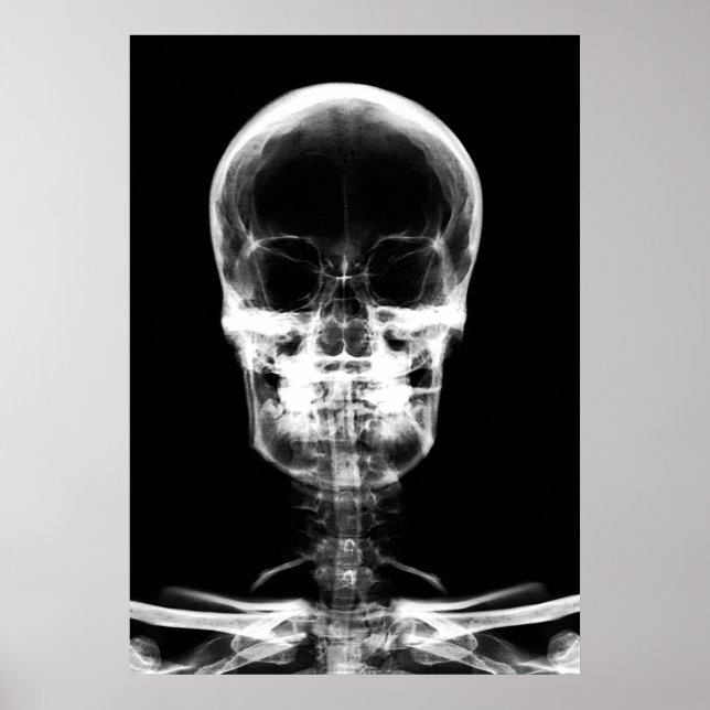 X-RAY VISION SKELETON SKULL - B&W POSTER (Framsidan)