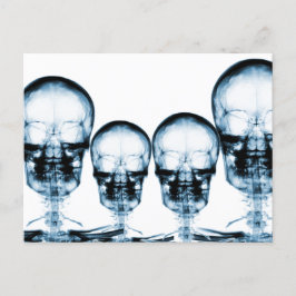 X-Ray Vision Skeleton Skull - Blue Vykort