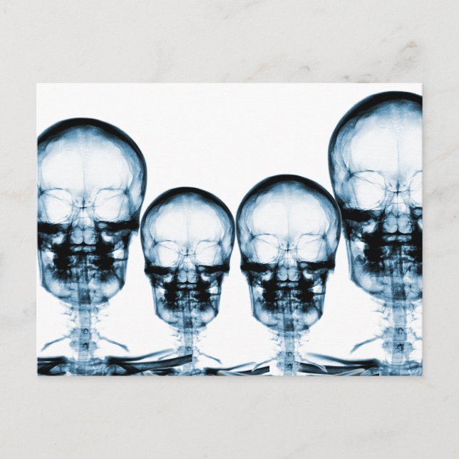 X-Ray Vision Skeleton Skull - Blue Vykort (Framsida)