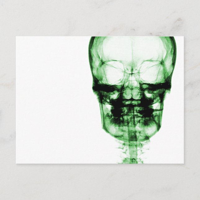 X-Ray Vision Skeleton Skull - Grönt Vykort (Framsida)
