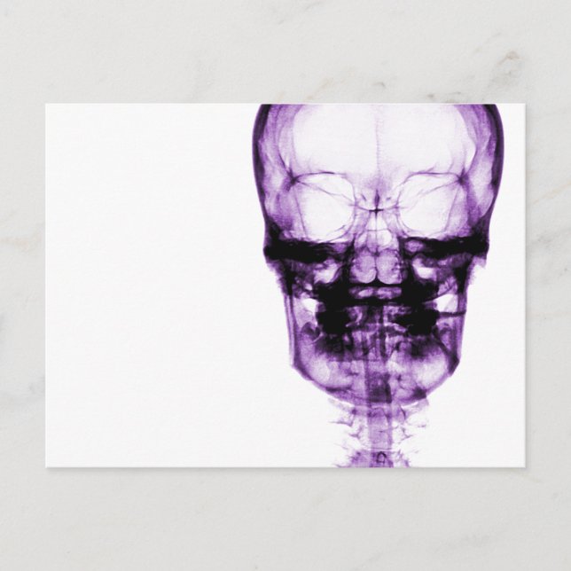 X-Ray Vision Skeleton Skull - Lila Vykort (Framsida)