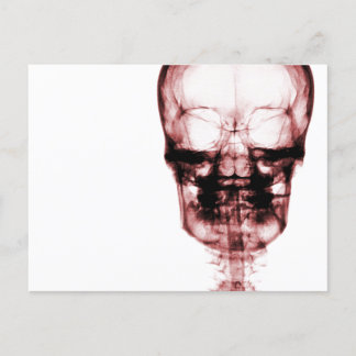 X-Ray Vision Skeleton Skull - Red Vykort