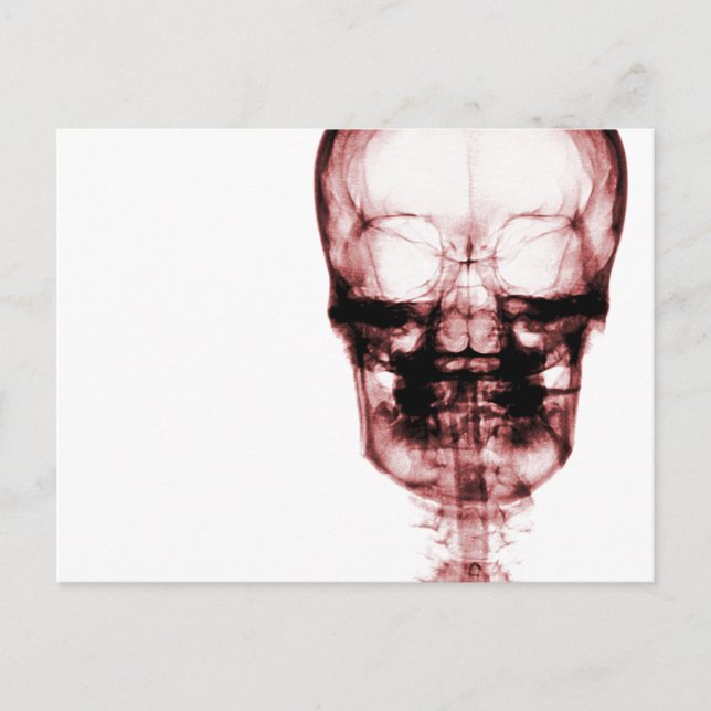 X-Ray Vision Skeleton Skull - Red Vykort (Framsida)