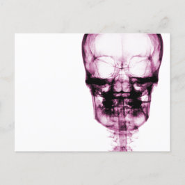 X-Ray Vision Skeleton Skull - Rosa Vykort