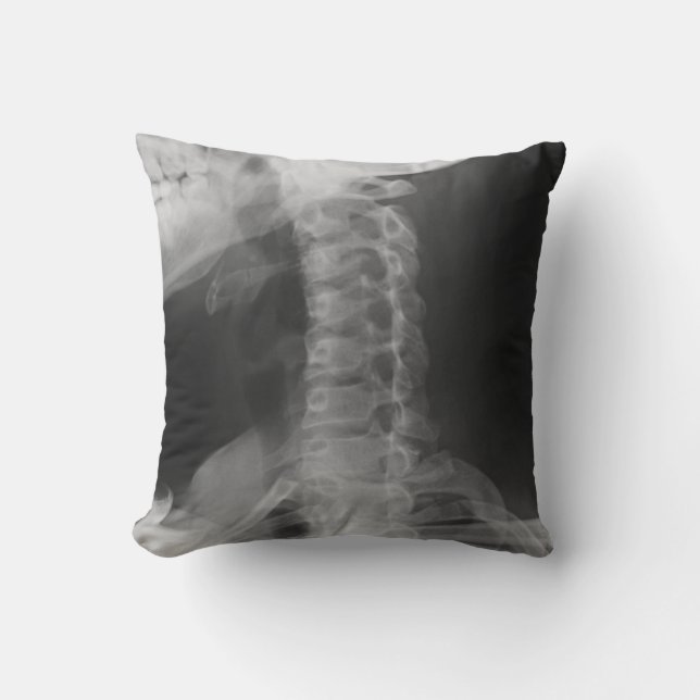 X-Rayed 2 (original) Kudde (Framsida)