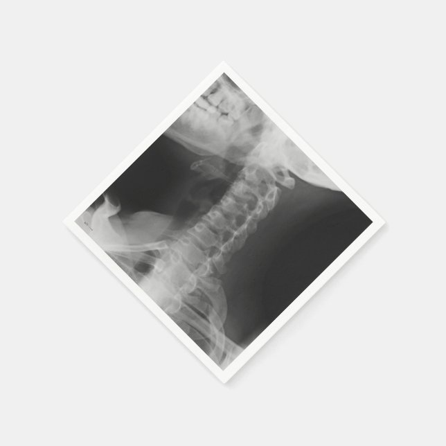X-Rayed 2 (original) Pappersservett (Hörn)