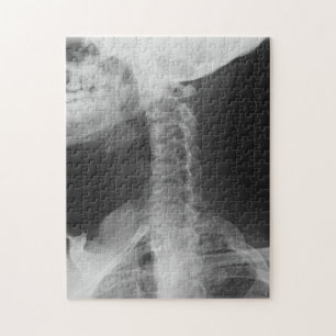 X-Rayed 2 (original) Pussel