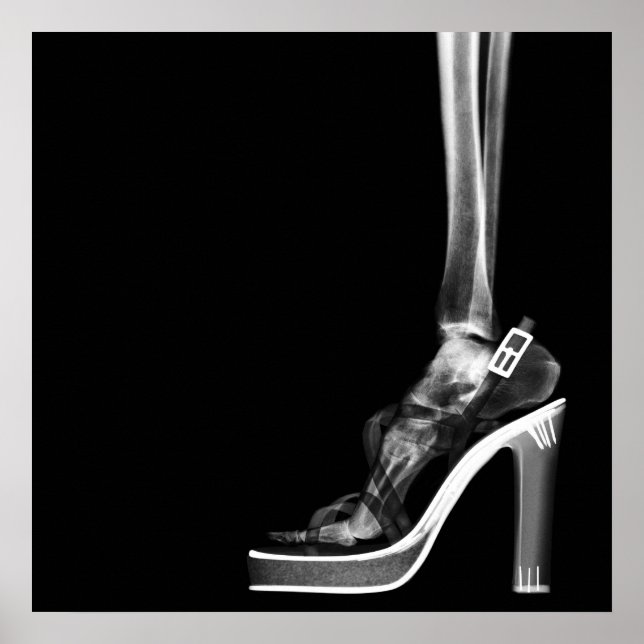 XRAY HIGH HEEL DAM SKELETON FOT B&W POSTER (Framsidan)