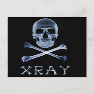 XRAY PIRAT Flagga RADIOLOGY JOLLY ROGER Vykort