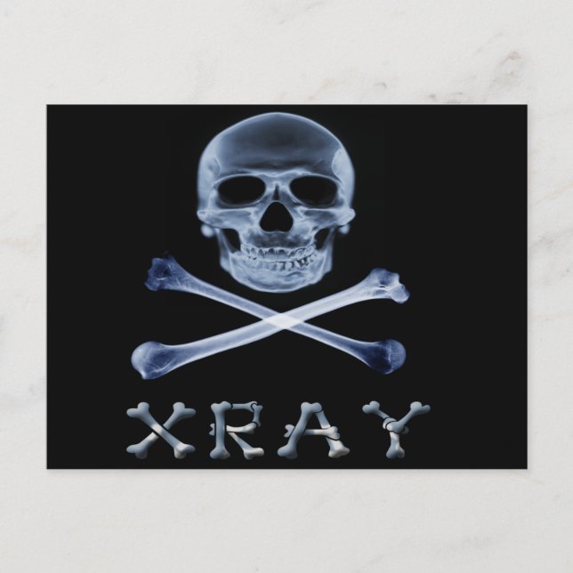 XRAY PIRAT Flagga RADIOLOGY JOLLY ROGER Vykort (Framsida)