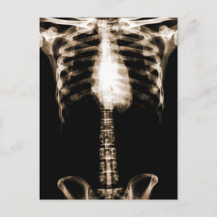 XRAY SKELETON TORSO RIBS SEPIA VYKORT