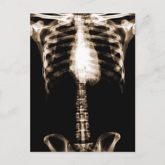 XRAY SKELETON TORSO RIBS SEPIA VYKORT (Framsida)