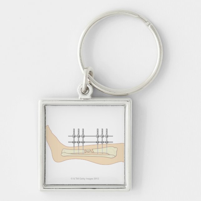 Yttre Fixator Fyrkantig Silverfärgad Nyckelring (Framsidan)